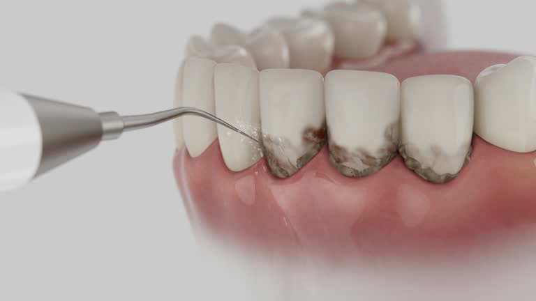 Trusted Tooth Extraction service in Ashton, ID - Dentist Open Now